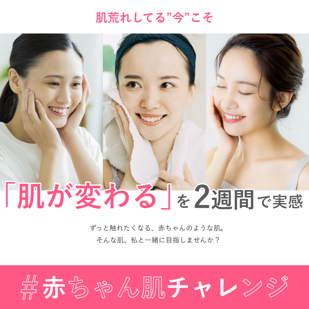 赤チャレサポート(7日間体験セット付き)
